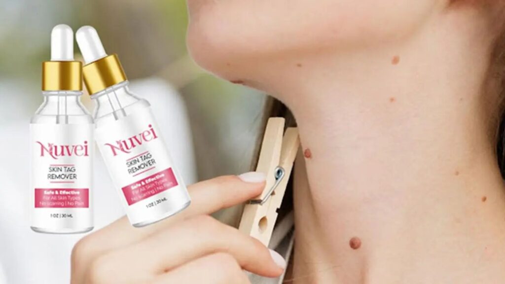 Nuvei Skin Tag Remover