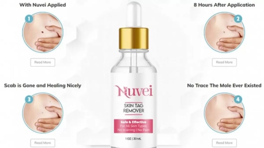 Nuvei Skin Tag Remover scam