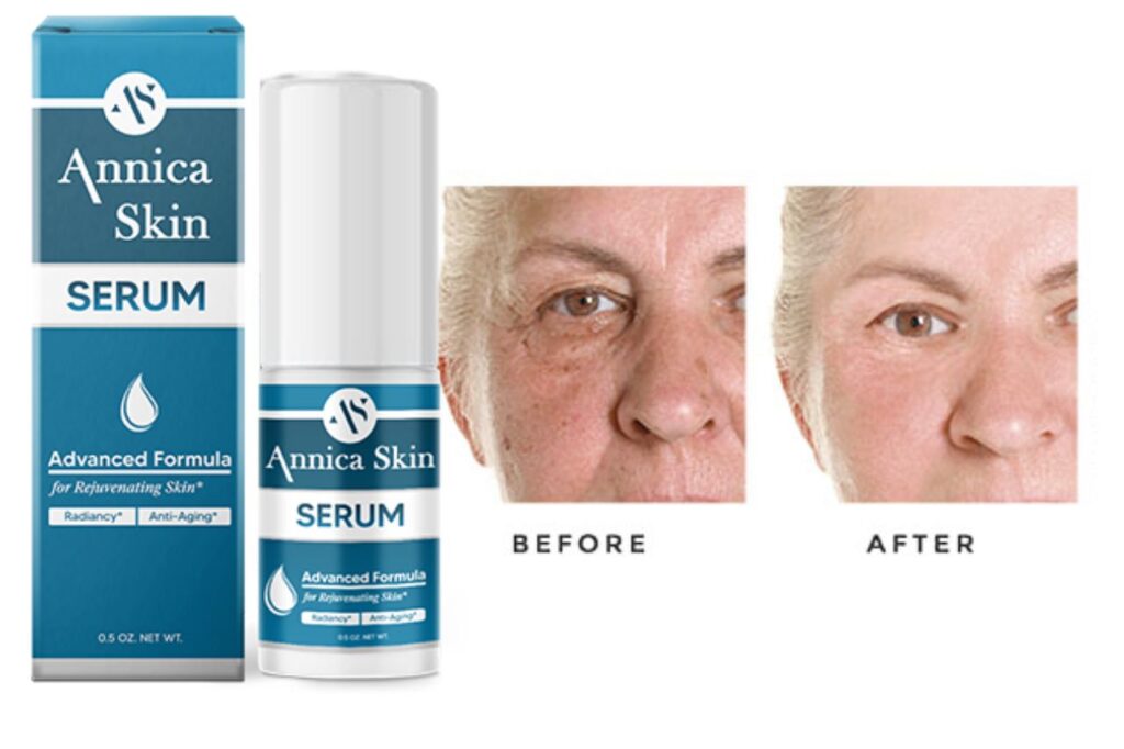 Annica Skin Serum Before and After